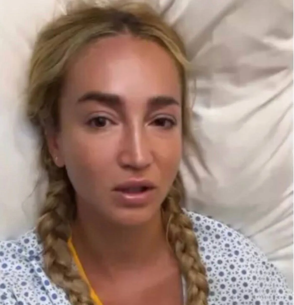 Сегодня увидела, что Ольга Бузова сломала ногу во время своего турне и ей сделали экстренно операцию
