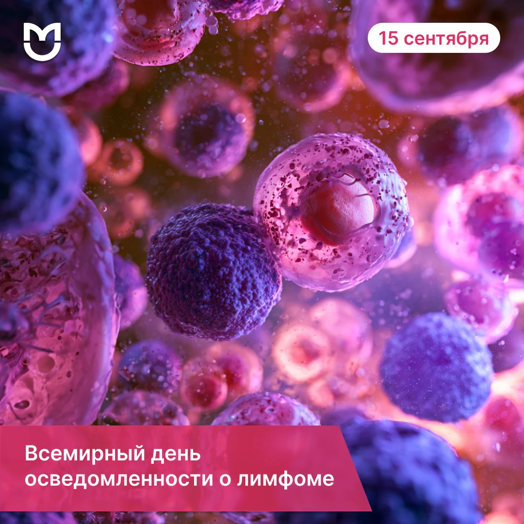 15 сентября — Всемирный день осведомленности о лимфоме
