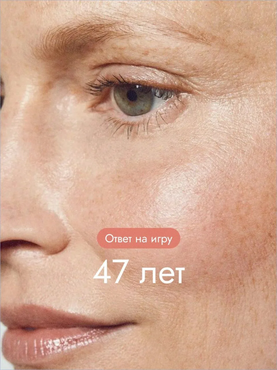 Правильный ответ — это кожа пациентки в 47 лет