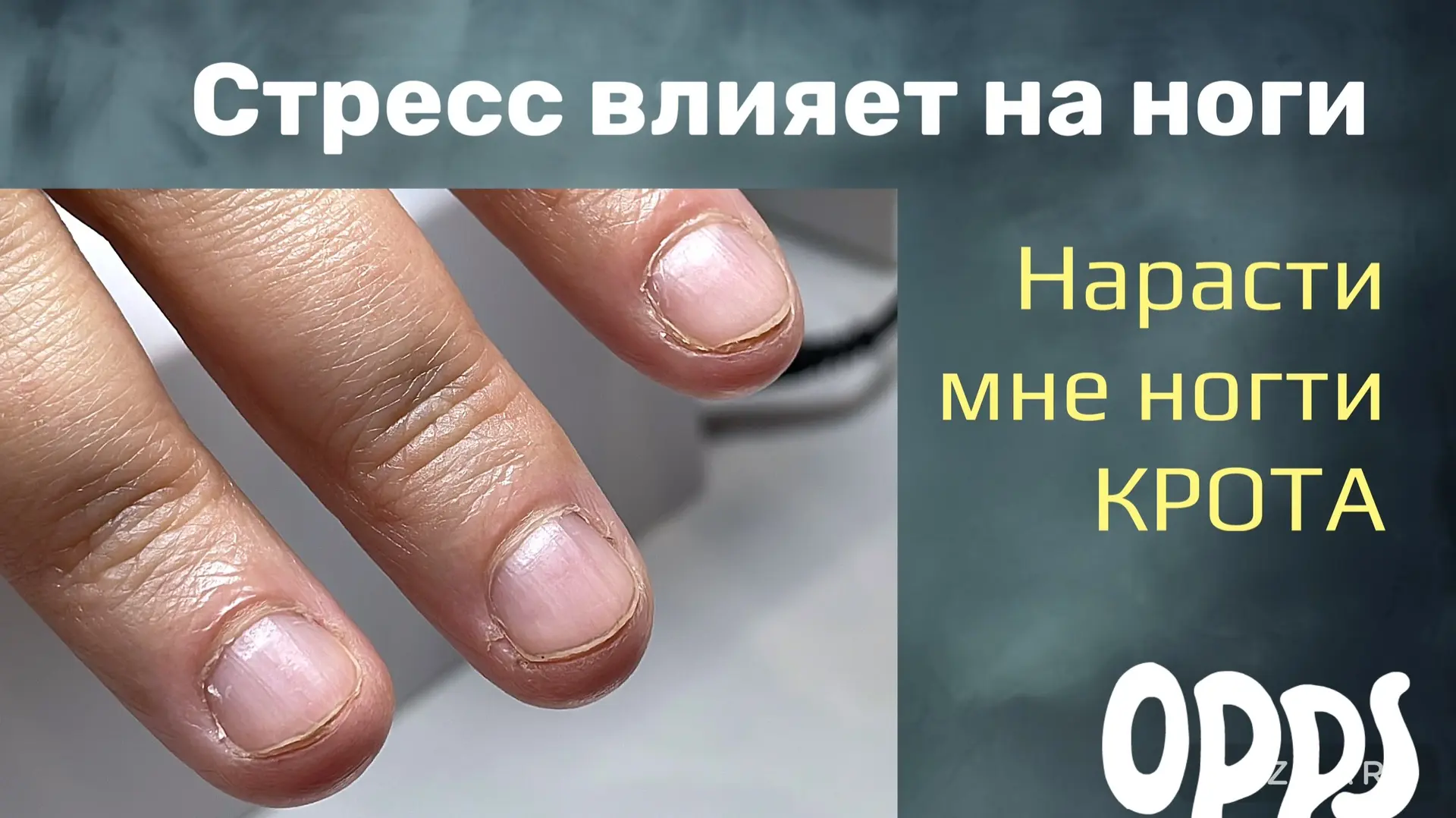 Нарасти мне ногти крота!
Ногти грызунчика. Верхние формы тут не подойдут. 

Со стороны видны все оши
