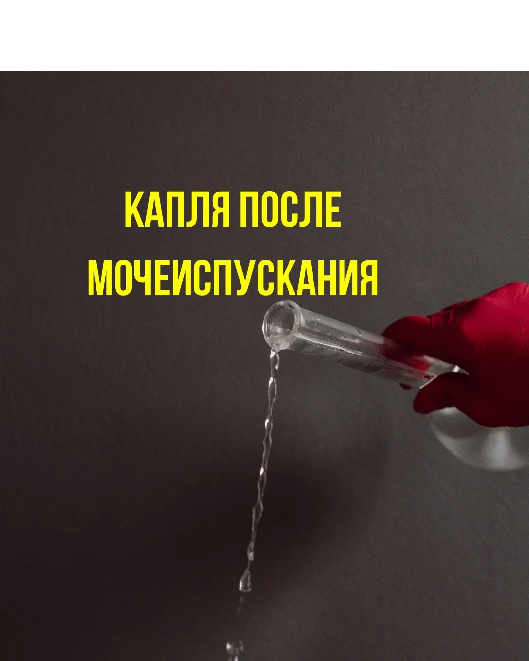 Что делать, если подтекает моча после мочеиспускания? 

✅ Поведенческая терапия туалетных привычек:

