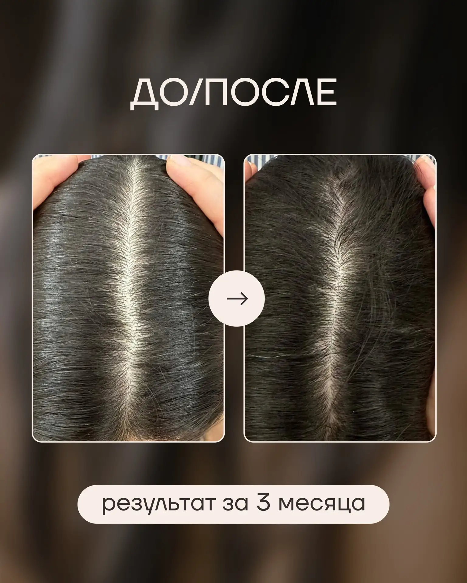 Этот набор рекомендуют трихологи👇🏻