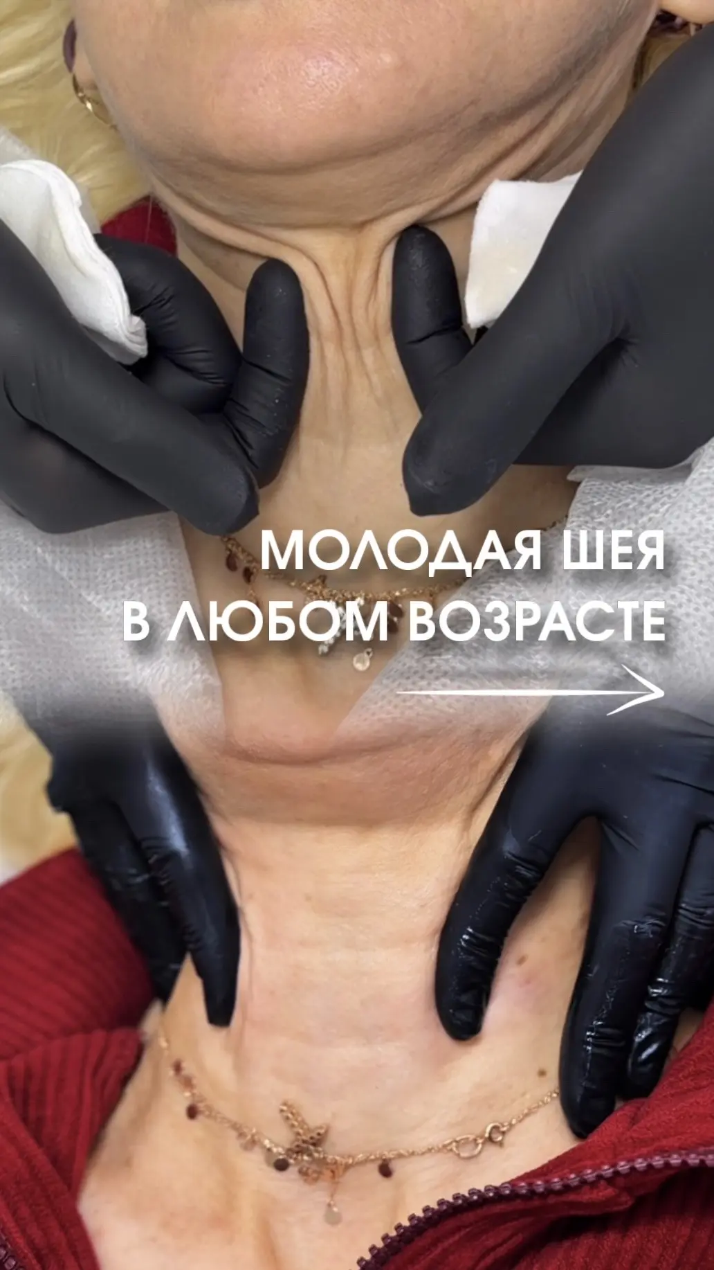 Шея и зона декольте могут выдавать возраст — но мы знаем, как вернуть молодость всего о...