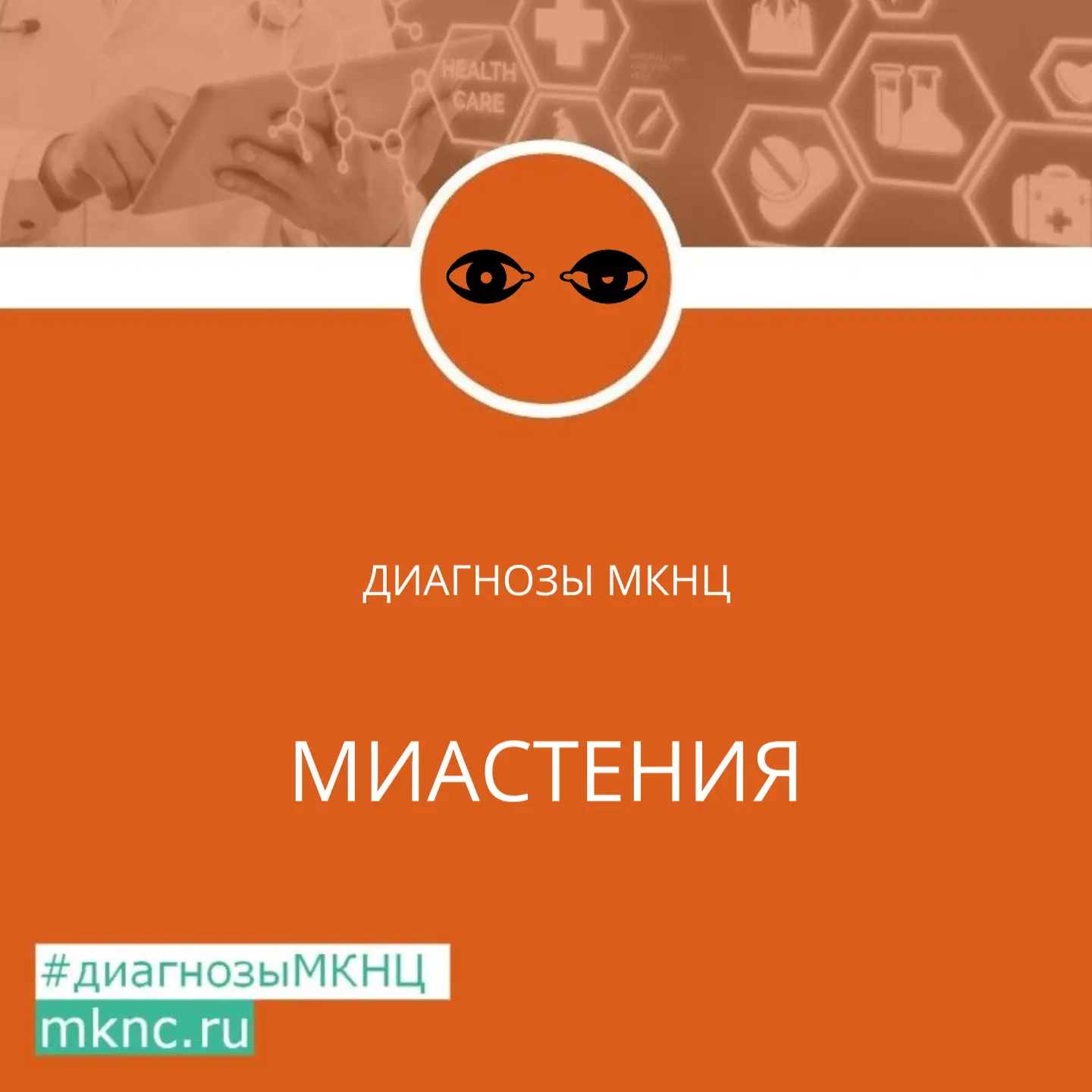 Миастения — одно из самых распространённых заболеваний, связанных с нарушением работы н...
