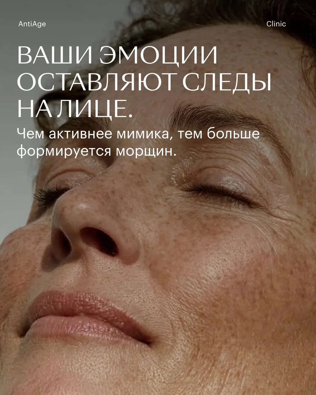 ДНИ ДИСПОРТА В ANTI AGE