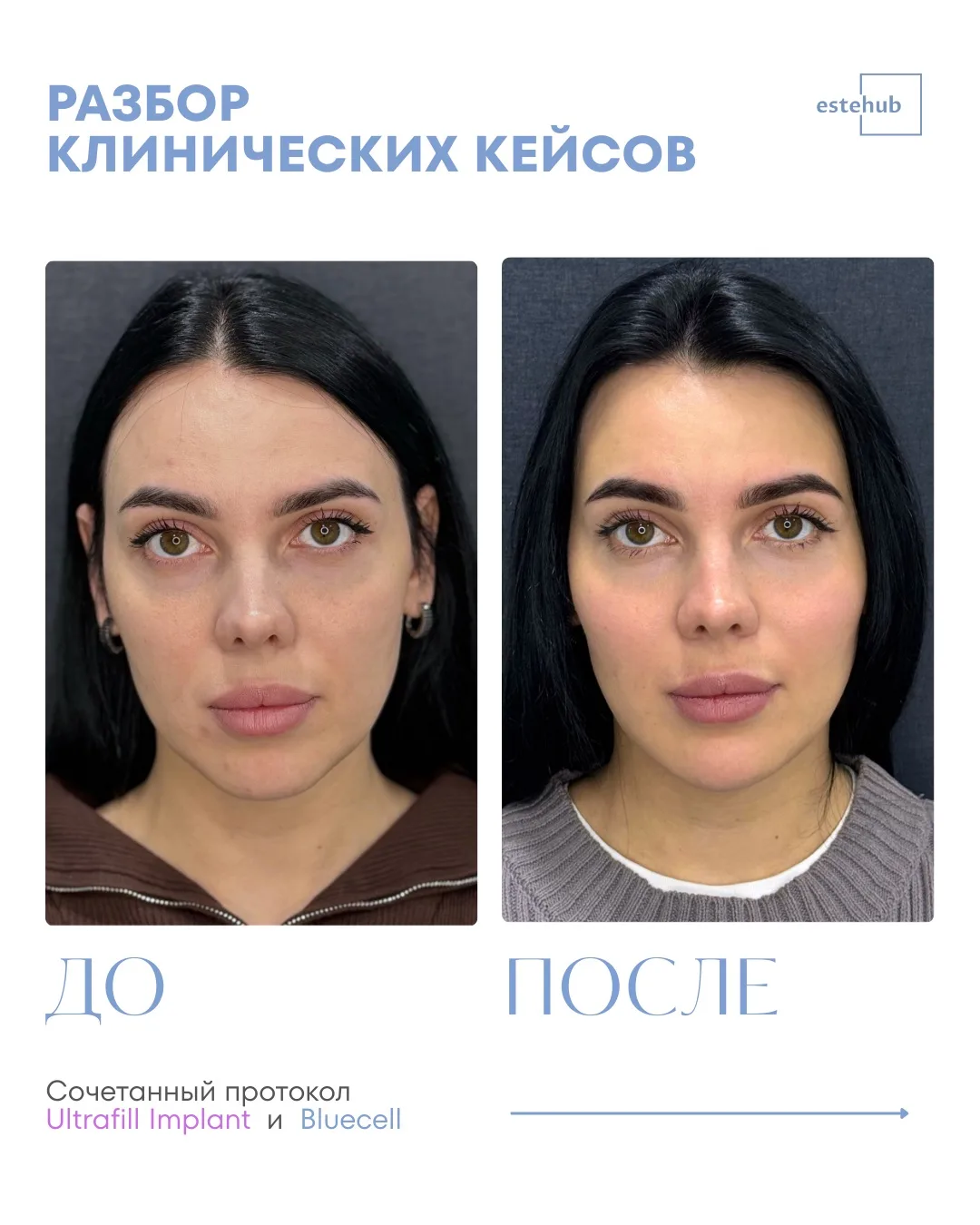🔍Разбор клинического кейса