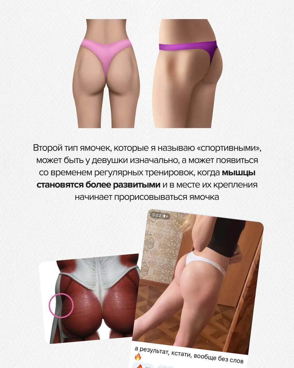 Как я убрала ямочки на ягодицах?
⠀⠀⠀⠀⠀⠀⠀⠀⠀⠀⠀⠀⠀⠀⠀⠀⠀⠀⠀⠀⠀⠀⠀⠀⠀⠀⠀⠀⠀⠀⠀⠀⠀⠀⠀⠀⠀⠀⠀⠀⠀⠀⠀⠀⠀⠀⠀⠀⠀
Дело в том, что у