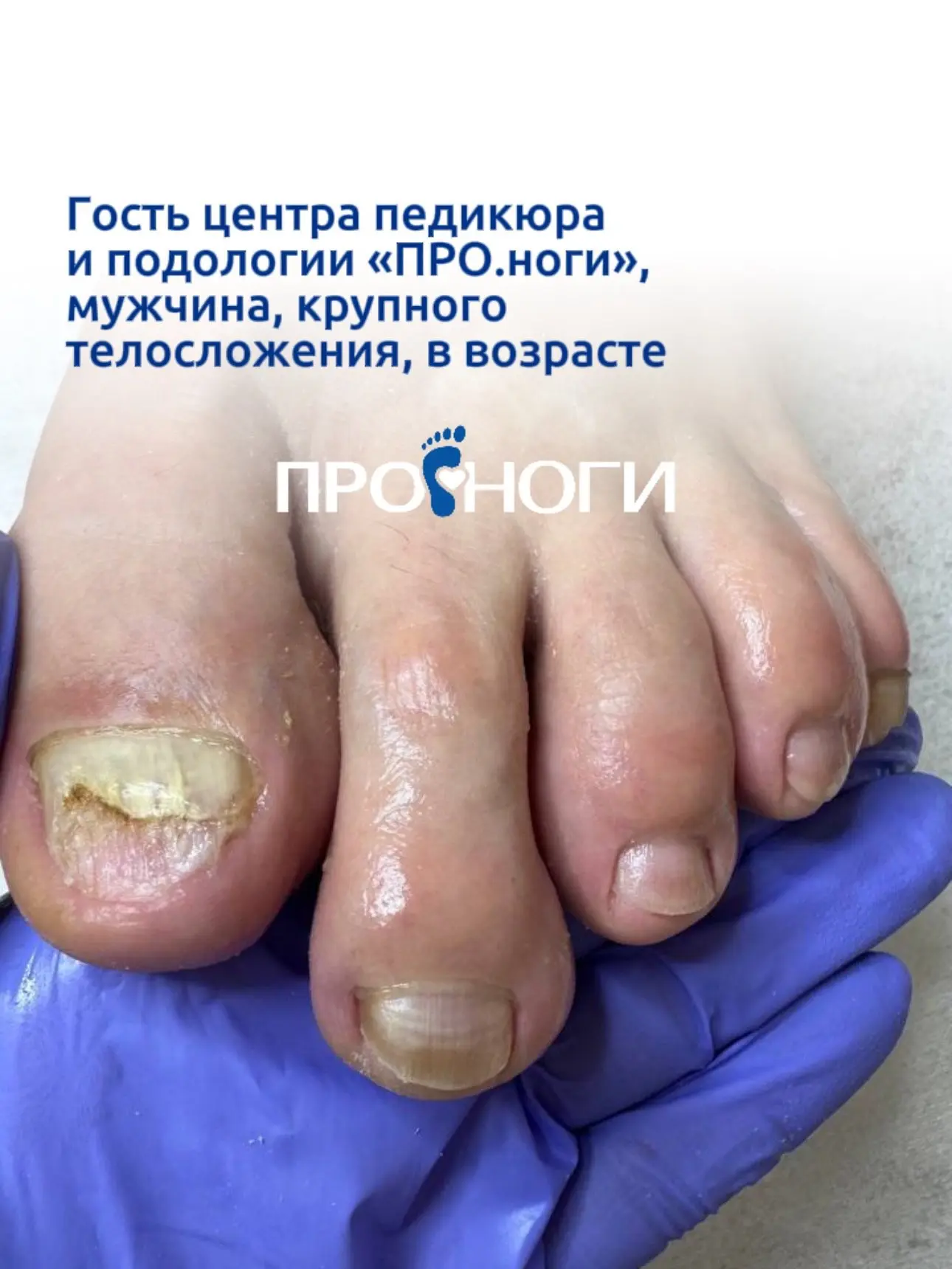 Новый кейс нашего центра 🔝 

Запись по ссылке mst.link/pronogi или по номеру 23-93-50

PRO.nogi 💙�
