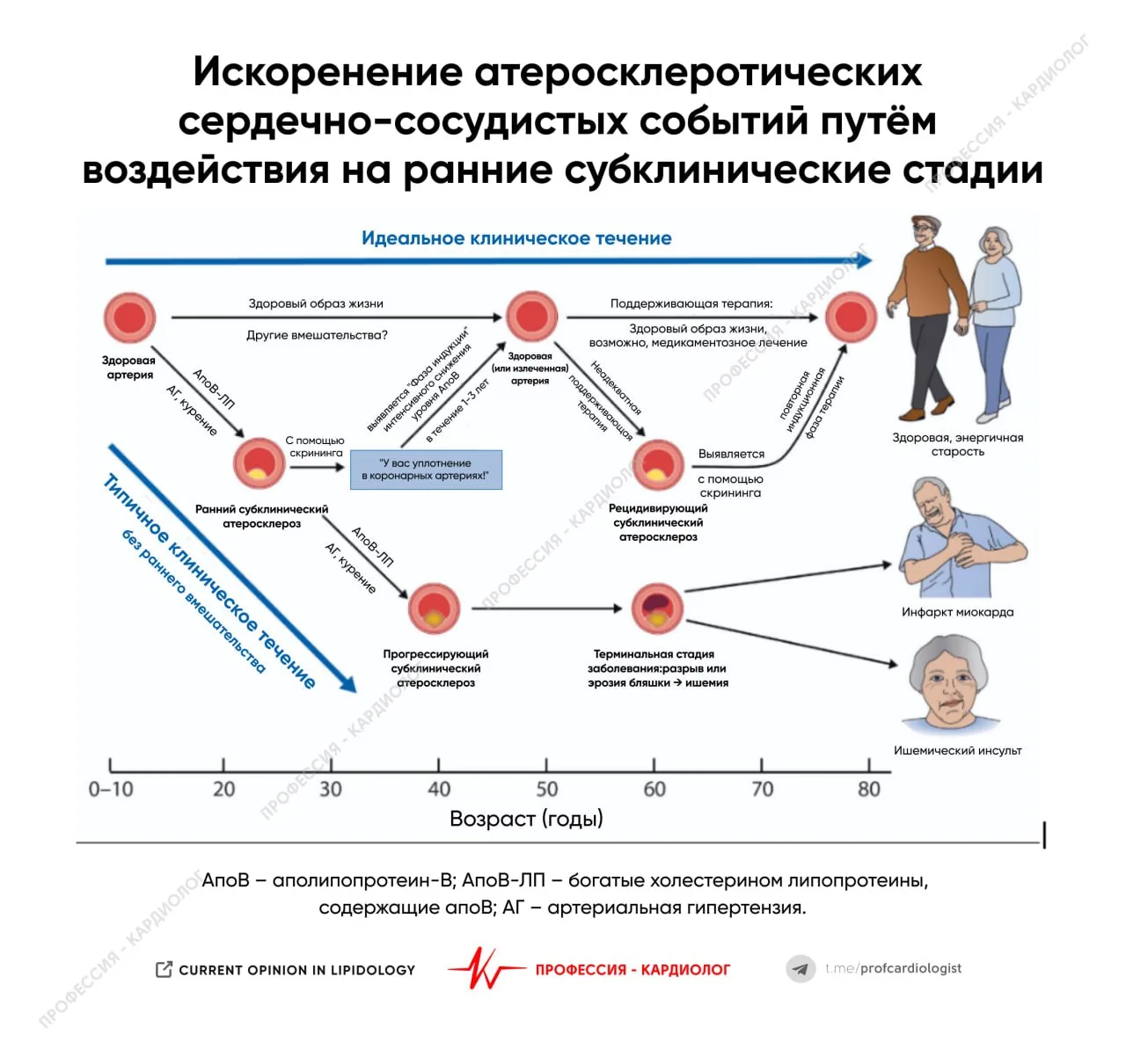 Воспаление и атеросклероз: альтернативное мнение