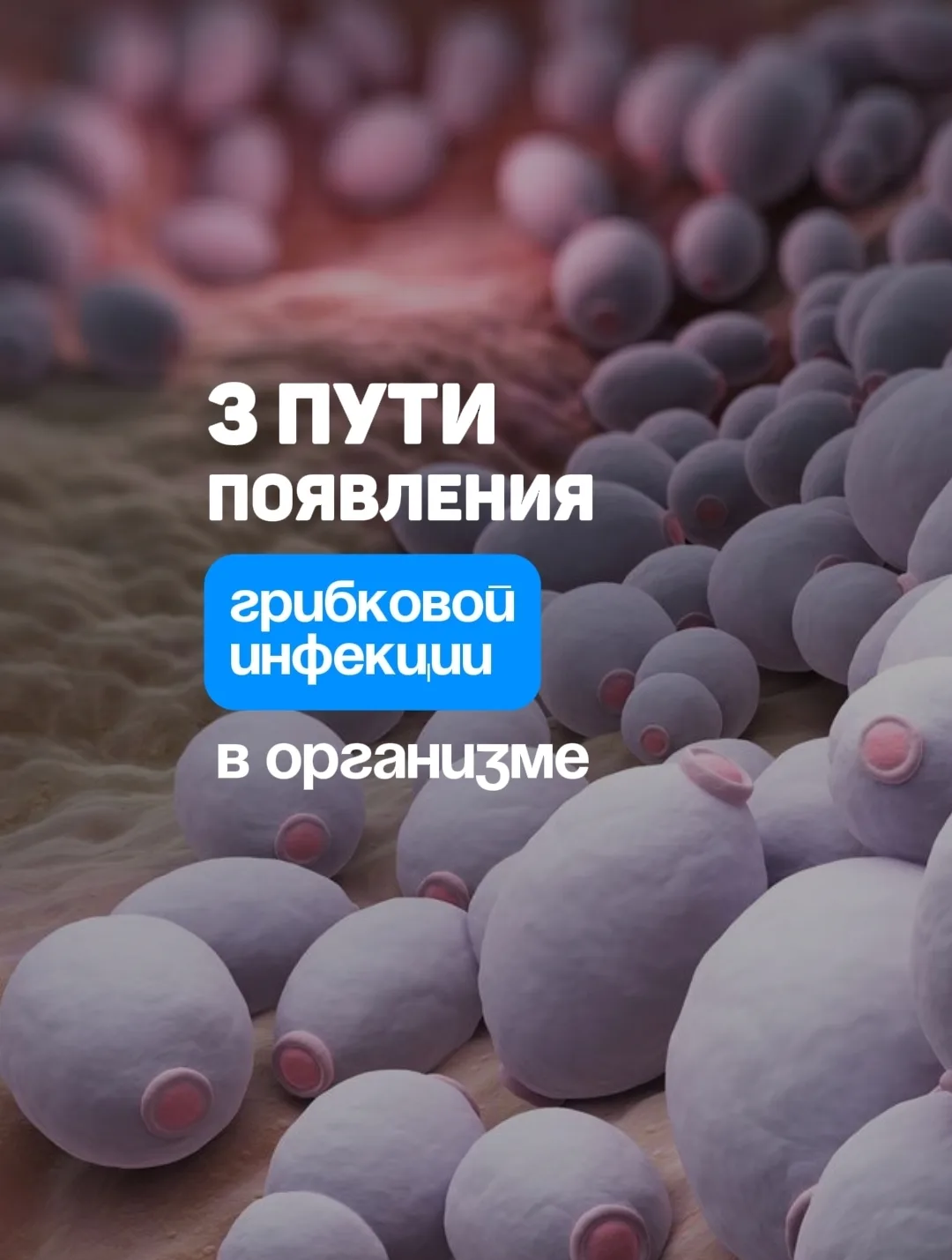 ➡️ 3 пути появления грибковой инфекции в организме