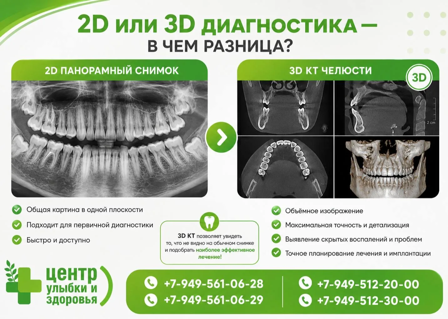 🦷2D или 3D: почему для сложного лечения одного снимка бывает недостаточно?
