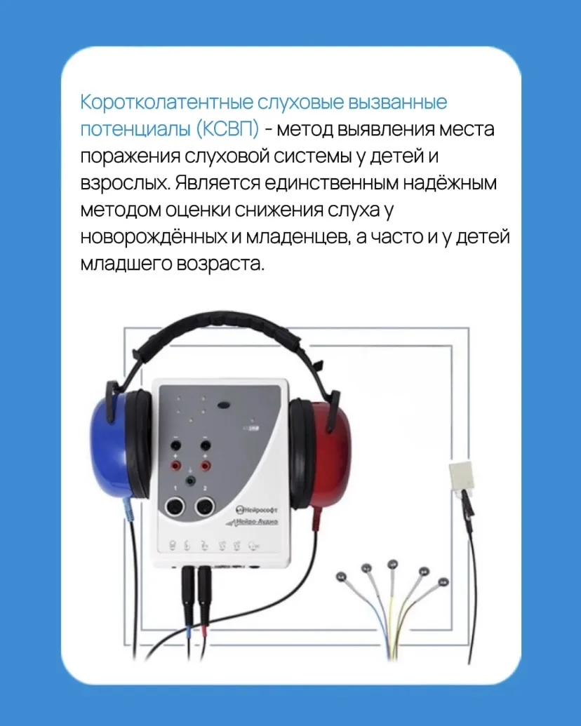 Коротколатентные слуховые вызванные потенциалы (КСВП)