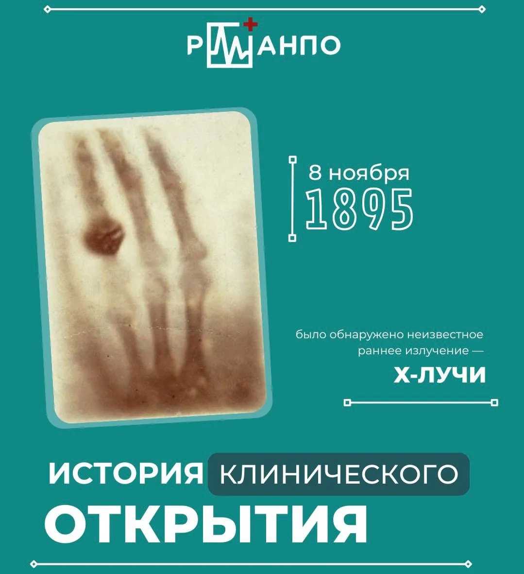 🩻Открытие рентгеновских лучей

В ноябре 1895 года немецкий физик Вильгельм Конрад Рентген изучал св