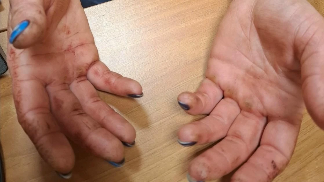 Жительница Урицкого района непреднамеренно убила бывшего супруга