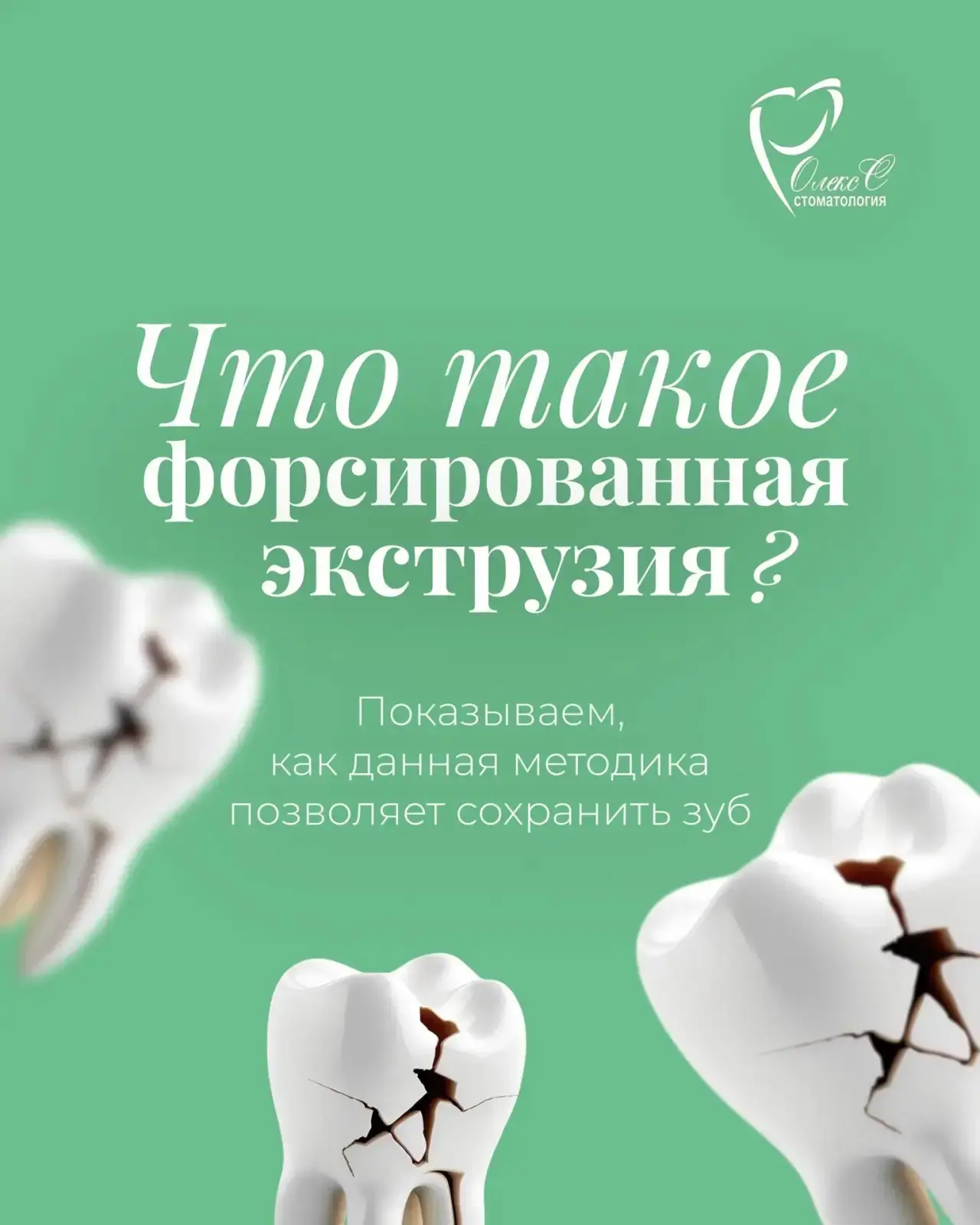 Форсированная экструзия — это методика, которая позволяет сохранить зуб даже в сложных ...