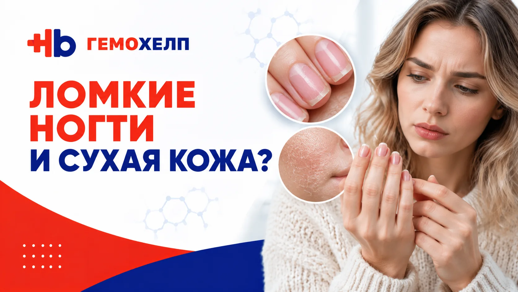Ломкие ногти и сухая кожа: какие анализы проверить?

Красивые волосы, крепкие ногти и здоровая кожа 