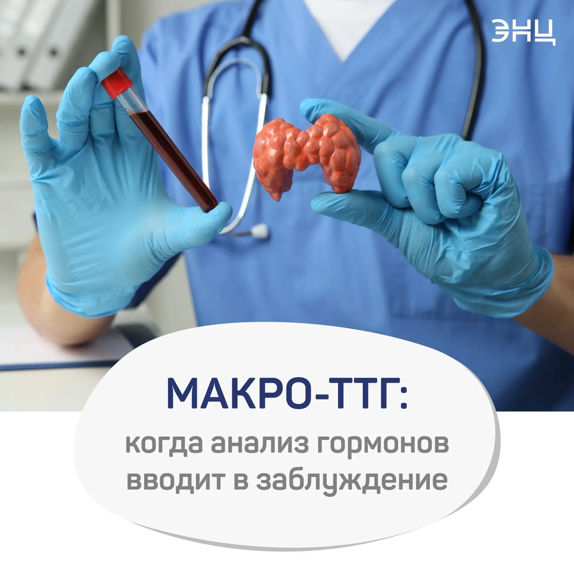 Макро-ТТГ: когда анализ гормонов вводит в заблуждение
 
📈 У некоторых пациентов анализ на ТТГ может