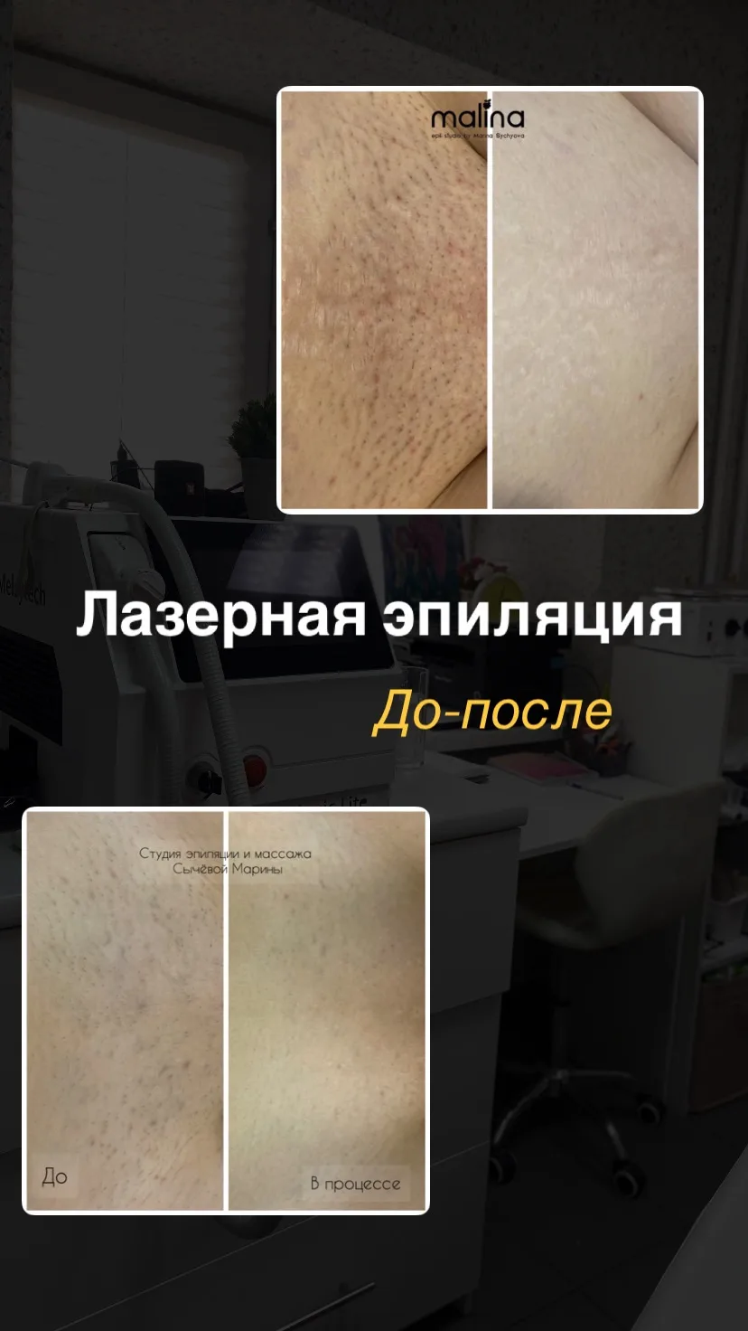 И КОНЕЧНО ВЫГОДНЕЕ ВСЕГО ЭТО ДЕЛАТЬ В АБОНЕМЕНТЕ