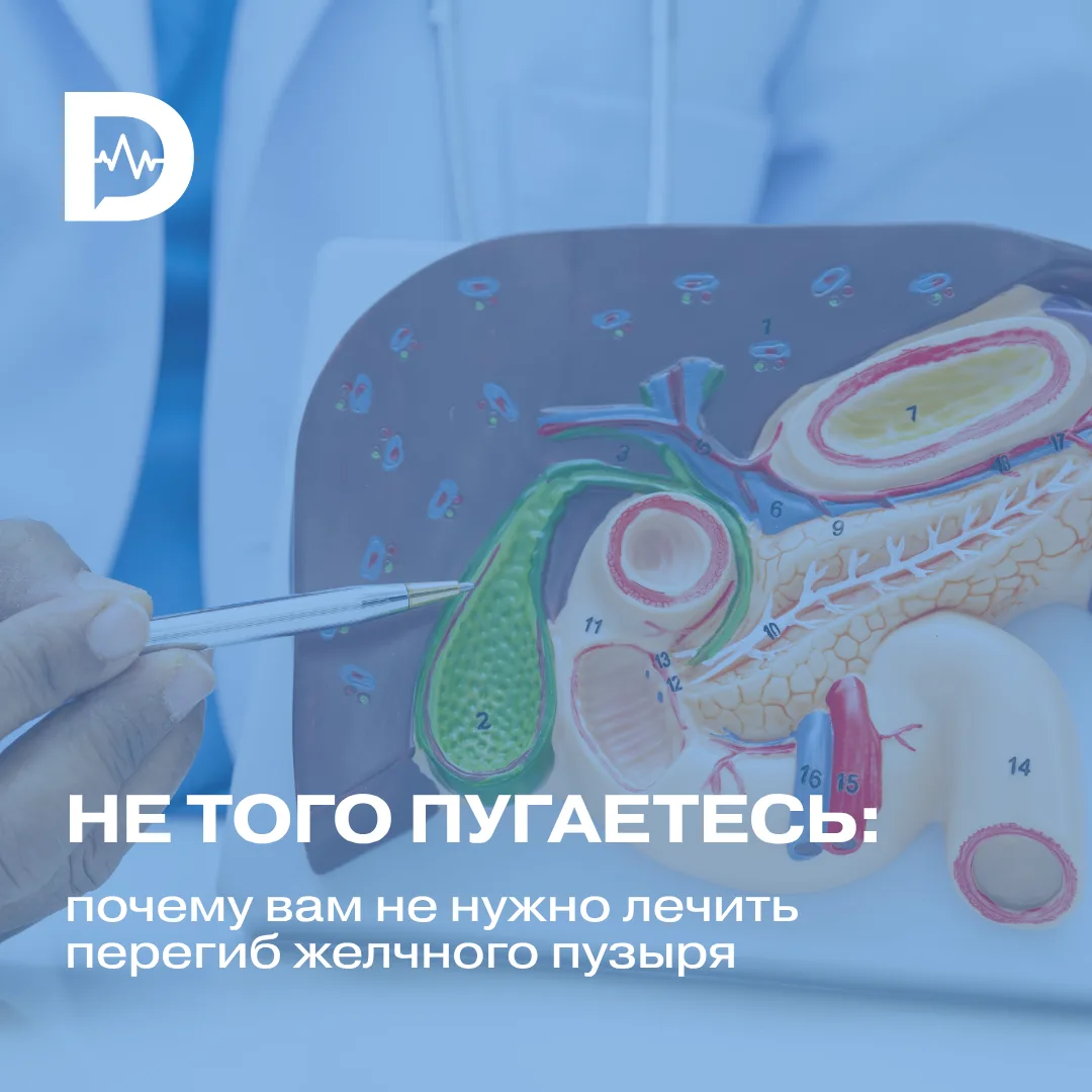 Увидели в заключении УЗИ фразу «перегиб желчного пузыря» и сразу решили, что у вас из-з...