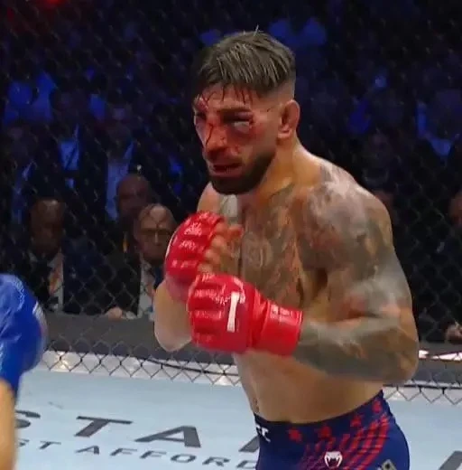Вот так выглядит лицо уже бывшего чемпиона UFC в лёгком весе Илии Топурии после боя с Джастином Гейд