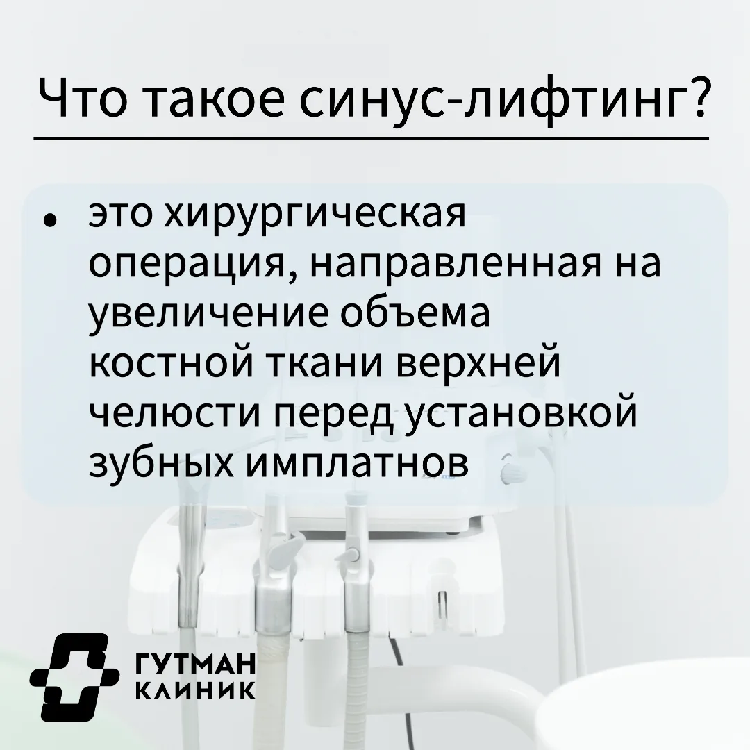 Что такое синус-лифтинг: просто о сложном!