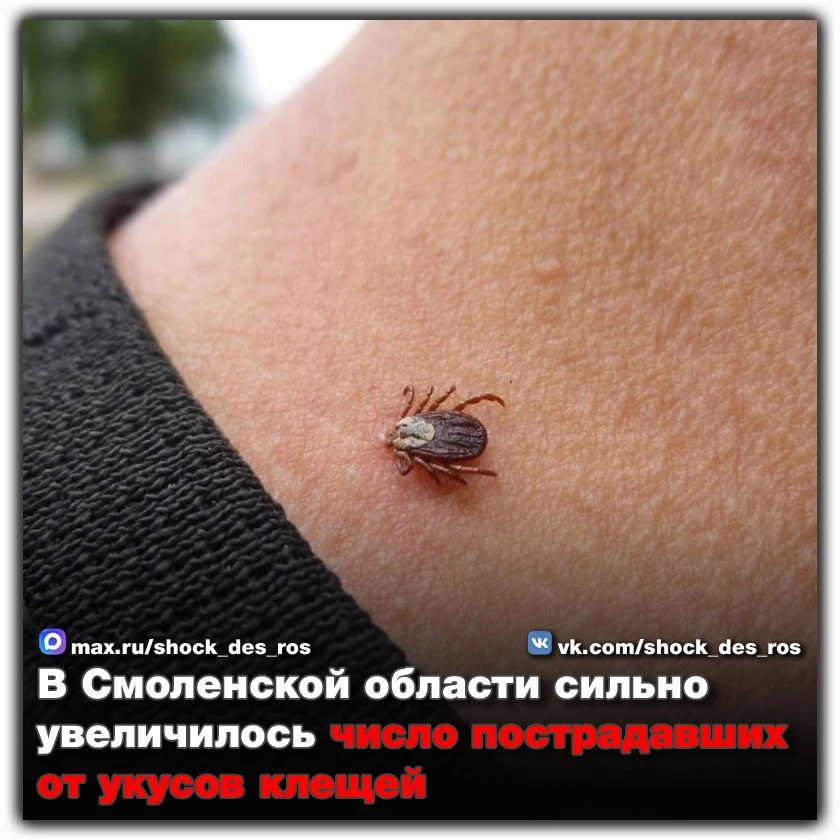 🔴 В Смоленской области сильно увеличилось число пострадавших от укусов клещей