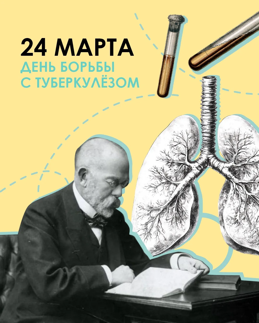 Туберкулёз многие считают болезнью прошлого. На самом деле микобактерия туберкулеза (па...