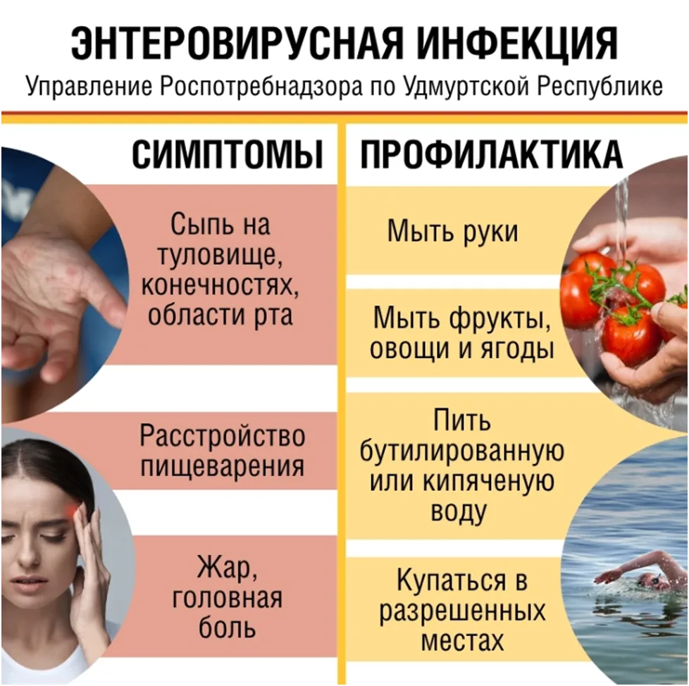 Внимание! Энтеровирусная инфекция