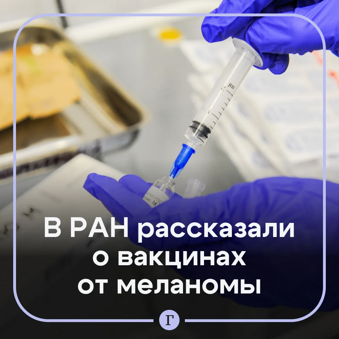 В России создали вакцины от меланомы для 12 пациентов.