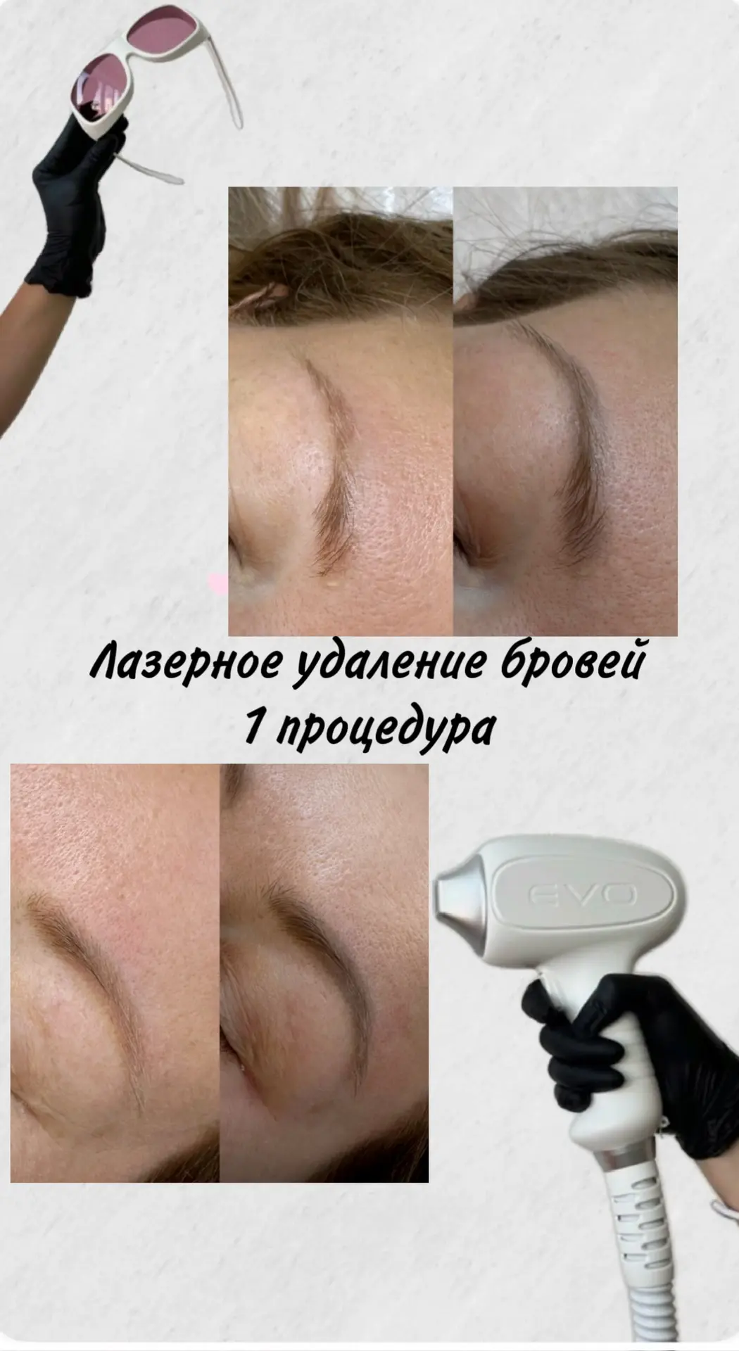 Чистые брови. Без истории🔬