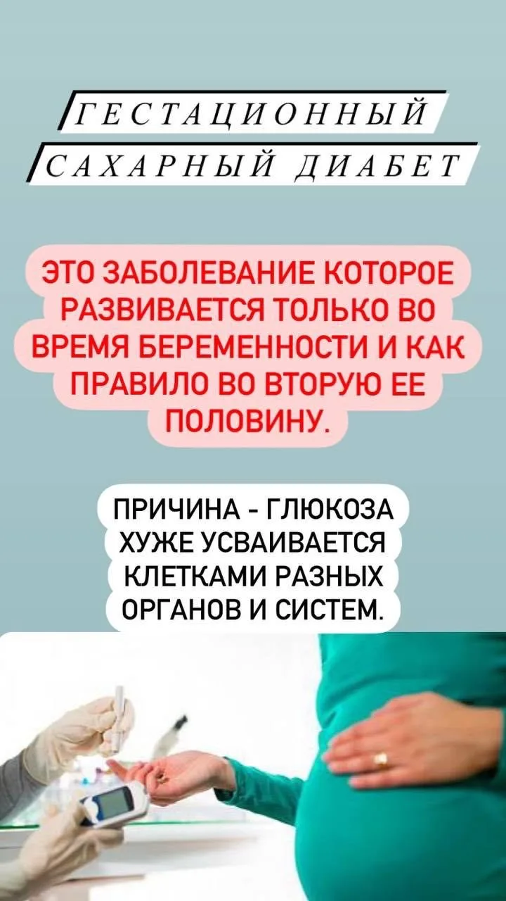 🔴ГСД