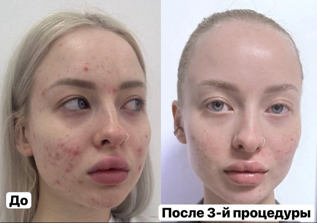Ночью получила сообщение от Вероники
