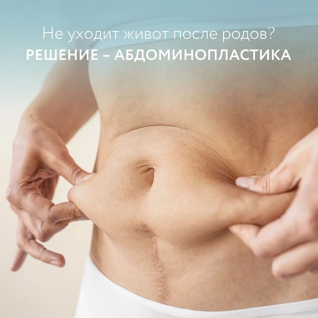 😞 Живот после родов: когда спорт уже не помогает