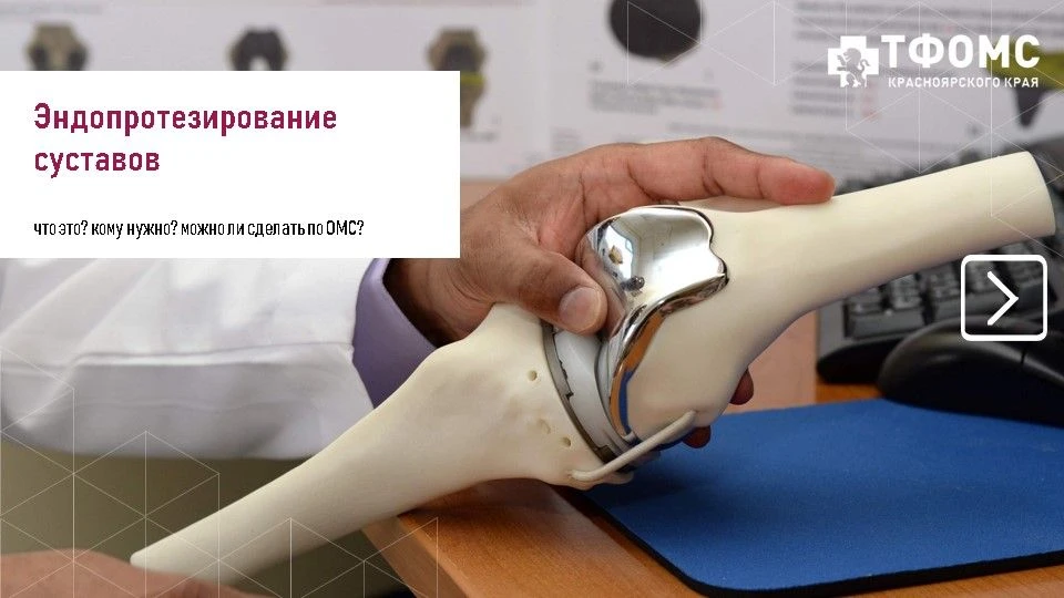 Эндопротезирование - это высокотехнологичная операция по замене поврежденного сустава н...