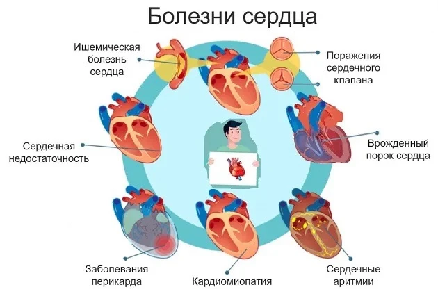 11 августа, — Международный день здорового сердца! ❤️