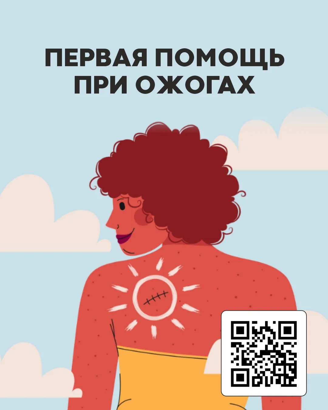 🚑Как оказать первую помощь при ожогах?