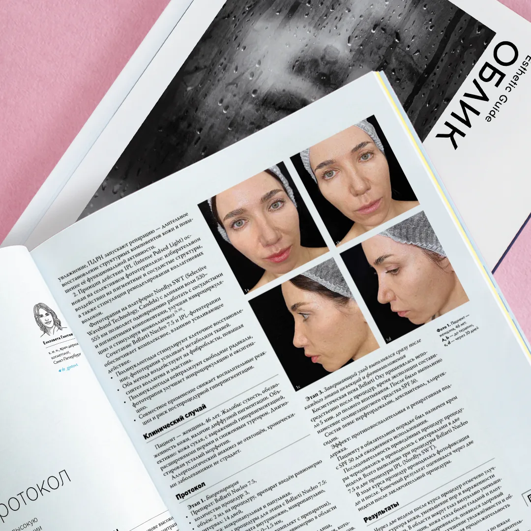 Комбинация биорепаранта Bellarti Nucleo 7.5 и IPL-фототерапии обеспечивает комплексную ...
