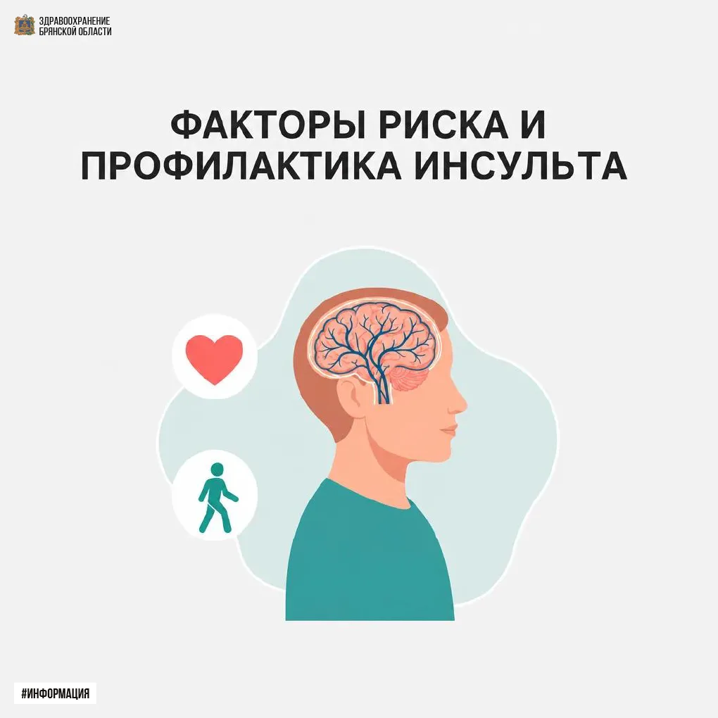 🛡️🧠 Факторы риска и профилактика инсульта