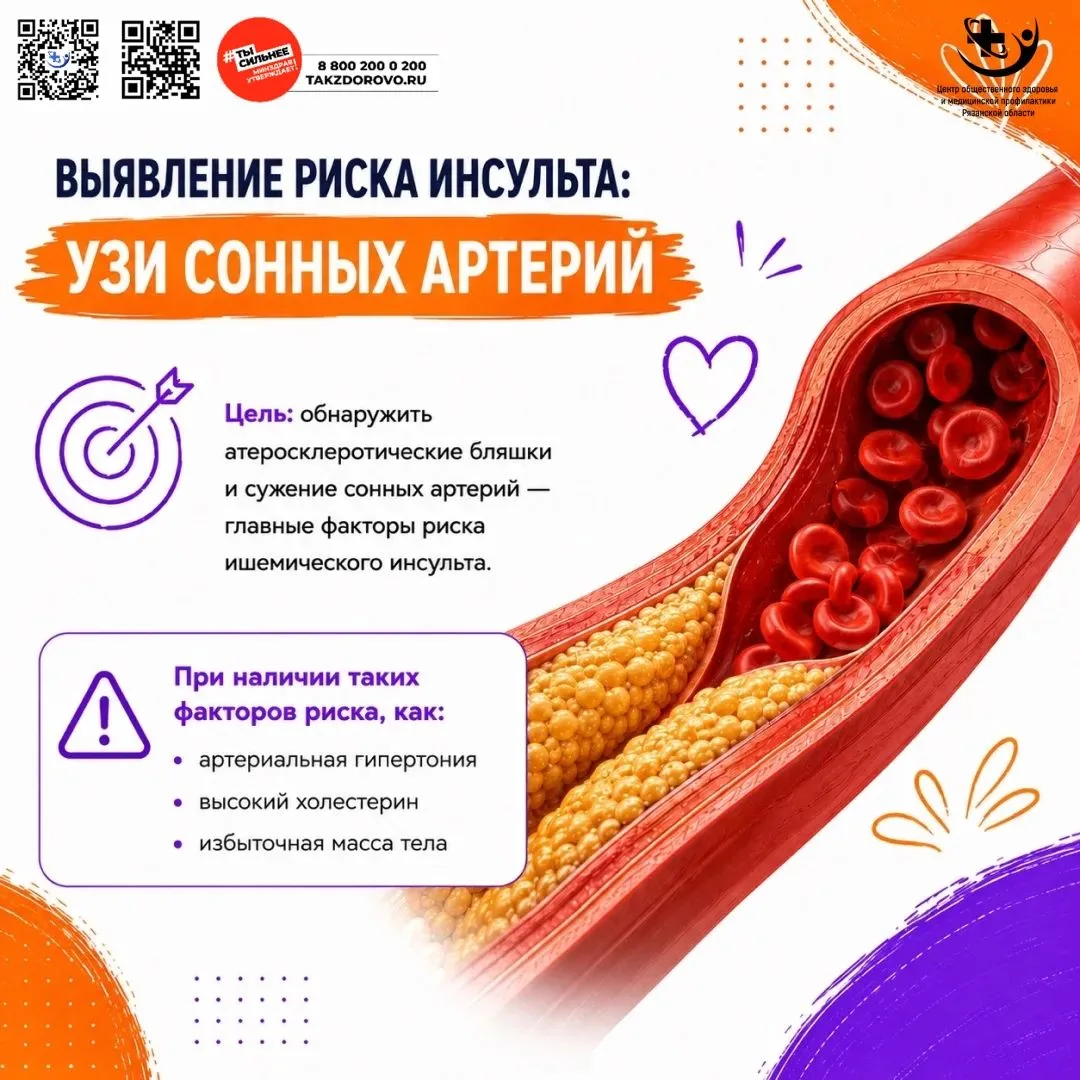 УЗИ сонных (брахиоцефальных) артерий в рамках диспансеризации входит во второй этап и п...