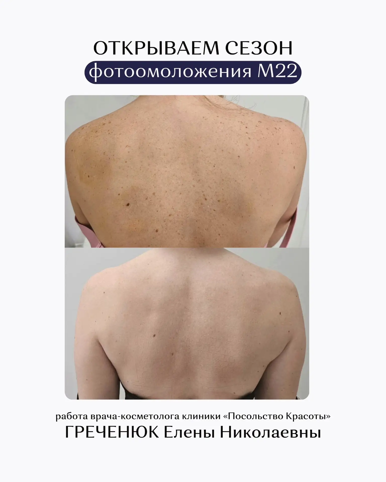 ОТКРЫВАЕМ СЕЗОН ФОТООМОЛОЖЕНИЯ M22 🔥
