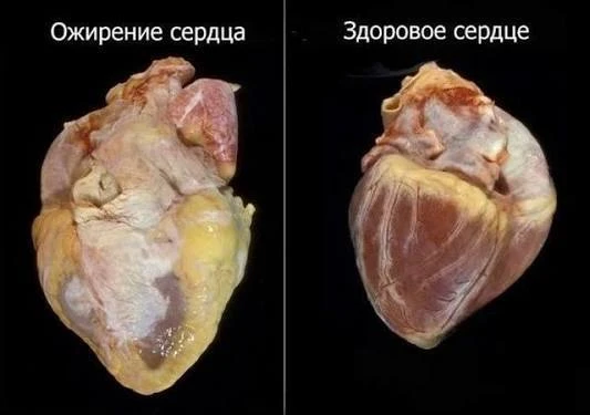100 000 ударов в сутки: Твой «мотор» не знает выходных! 💓