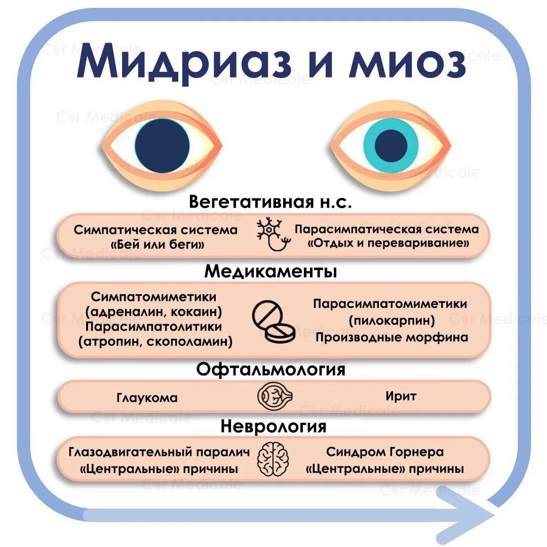 Мидриаз и миоз