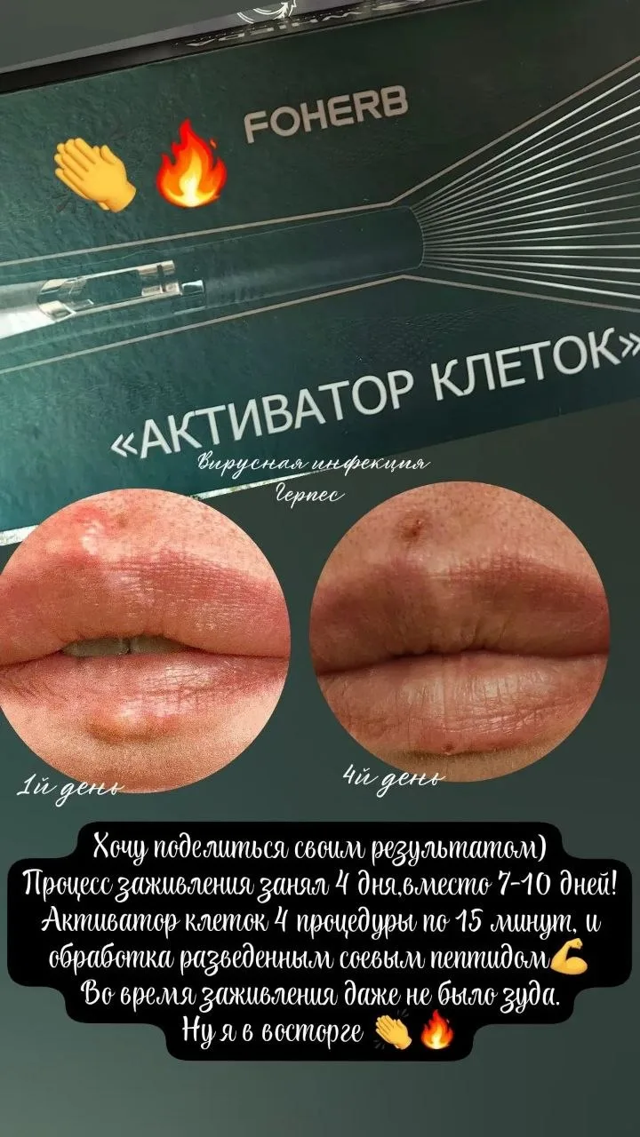 👏 Отзыв об Активаторе клеток