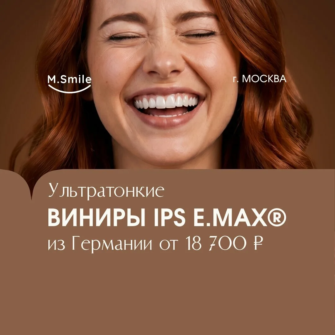 Керамические виниры IPS E.MAX®. От 18 700 ₽ за винир!