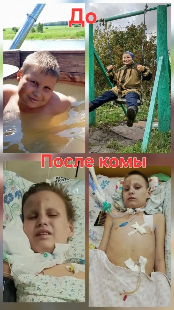 Максим остался жить — ему очень нужна ваша помощь 🙏