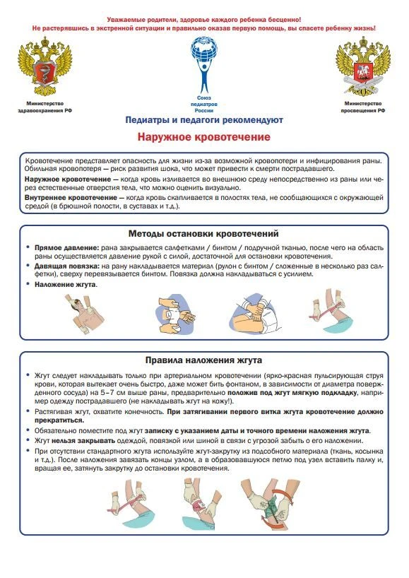 Наружное кровотечение