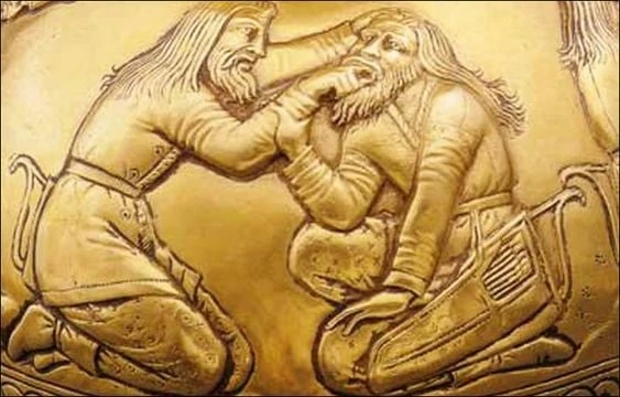 Скифская стоматология. 
 
Исцеление больного кочевника.