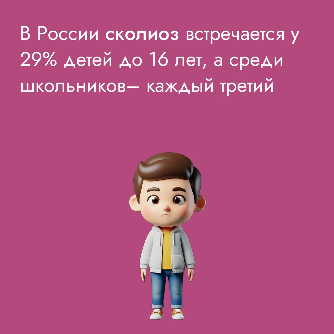 В России сколиоз встречается у 29% детей-подростков до 16-ти лет, а среди школьников распространённо