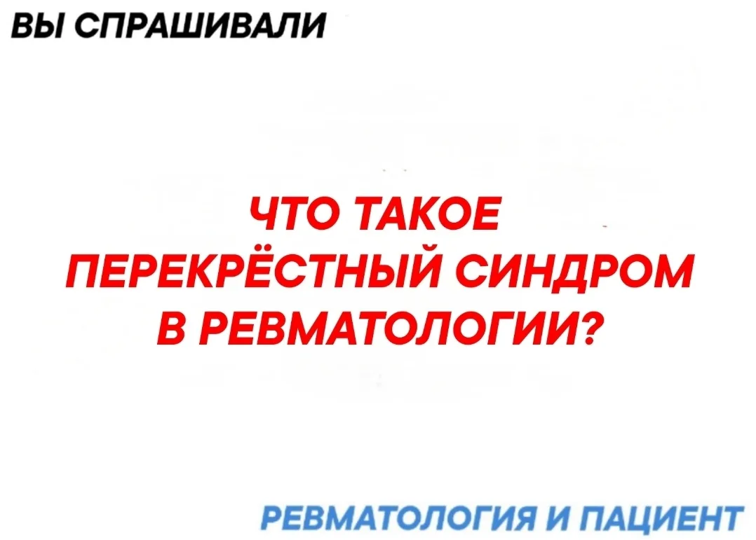 «Перекрёстный синдром» (overlap syndrome) в ревматологии — это ситуация, когда у пациен...