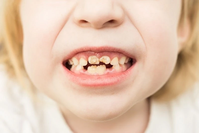 🦷 Почему у вас «плохие» зубы? Разбираем детские ошибки, которые до сих пор влияют на в...